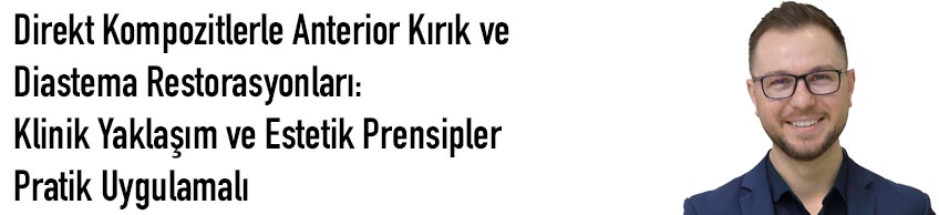 Direkt Kompozitlerle Anterior Kırık ve Diastema Restorasyonları: Klinik Yaklaşım ve Estetik Prensipler - Pratik Uygulamalı