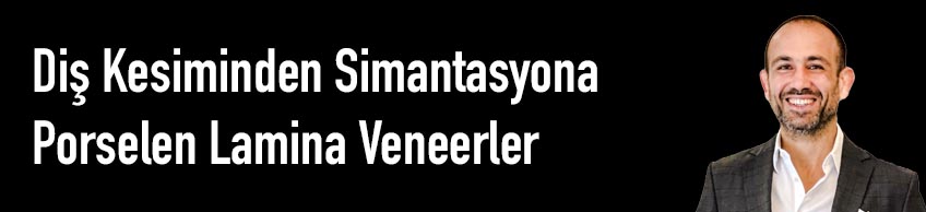 Diş Kesiminden Simantasyona Porselen Lamina Veneerler