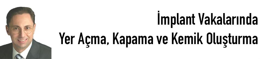 İmplant Vakalarında Yer A&ccedil;ma, Kapama ve Kemik Oluşturma