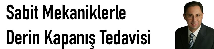 Sabit Mekaniklerle Derin Kapanış Tedavisi - Pratik Uygulamalı