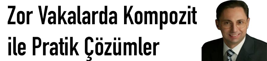 Zor Vakalarda Kompozit ile Pratik Çözümler